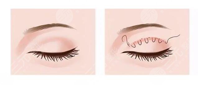 上海鄒功偉醫(yī)生簡(jiǎn)介-技術(shù)特色