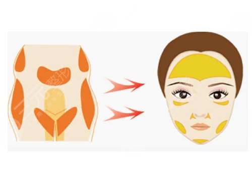 軍美唐國(guó)強(qiáng)醫(yī)生做手術(shù)怎么樣