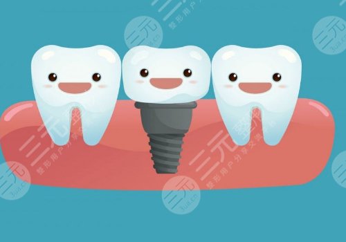 正常種一顆牙多少錢