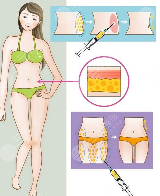 深圳陽(yáng)光醫(yī)療美容醫(yī)院特色項(xiàng)目