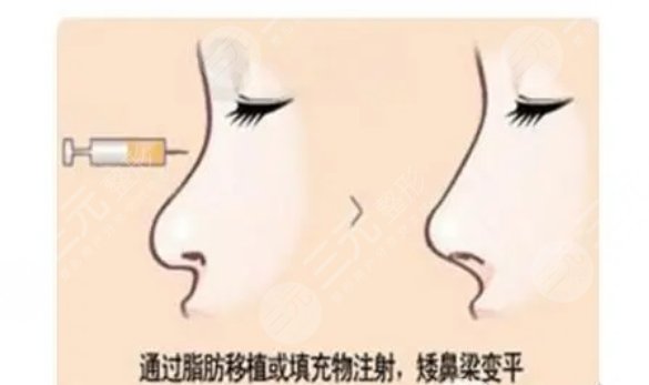 上海華美醫(yī)療美容醫(yī)院擅長項目