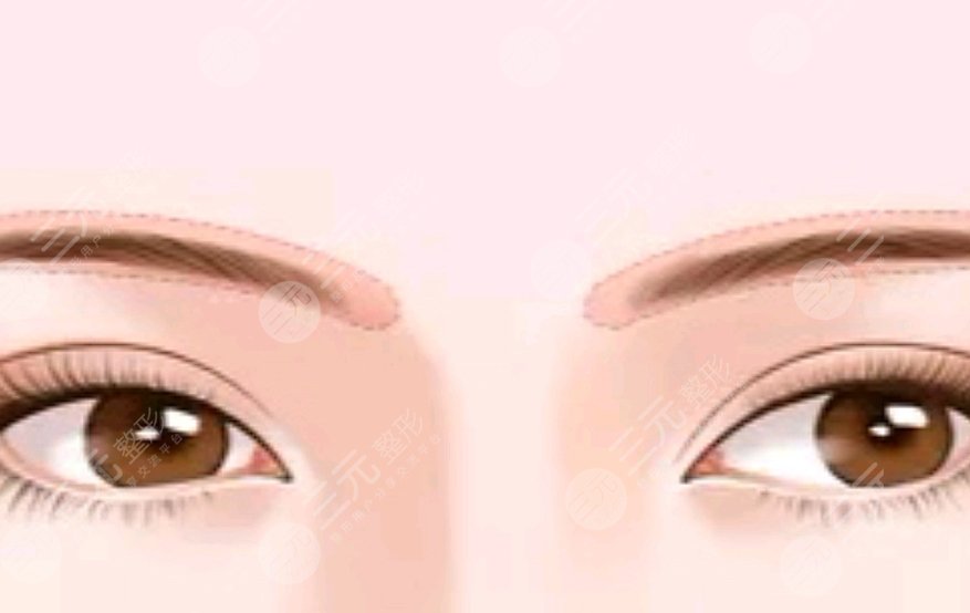 眉毛種植動(dòng)