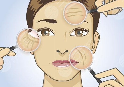 全臉脂肪填充5到10天照片