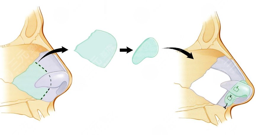 深圳陽光醫(yī)療美容醫(yī)院擅長科普知識
