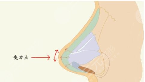 寧波藝星做鼻子醫(yī)生那個好？盧燕明假體隆鼻結(jié)果分享，寧波隆鼻醫(yī)生合集