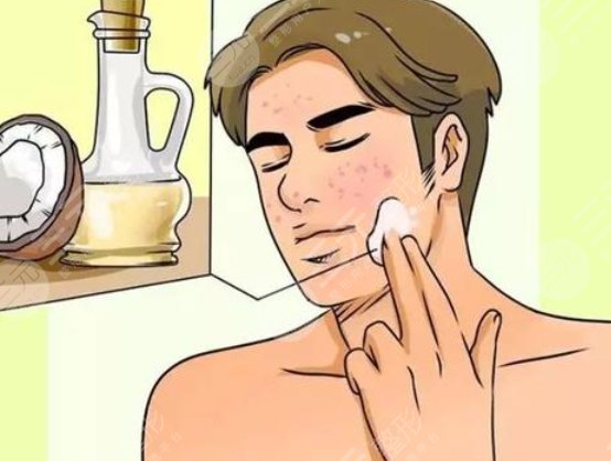 男生美白項目動漫01