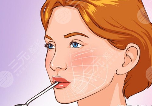 小拉皮怎么做的,手術切口在哪里