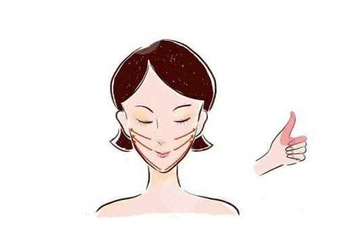 金云波中面部提升案例