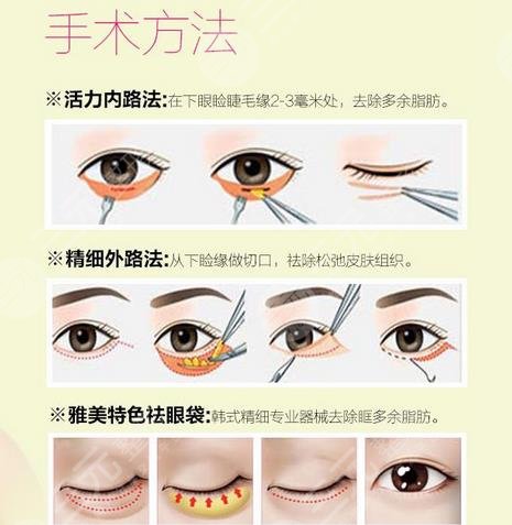 北京美萊醫(yī)療美容醫(yī)院科普知識