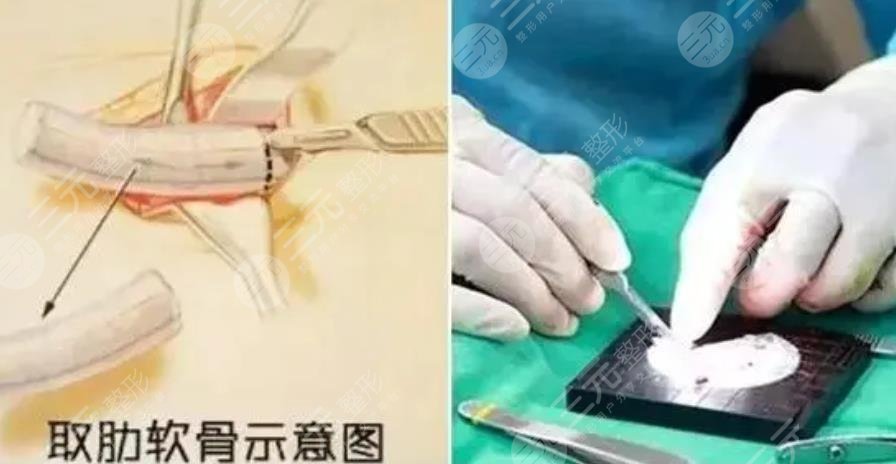 深圳陽光醫(yī)療美容醫(yī)院科普知識