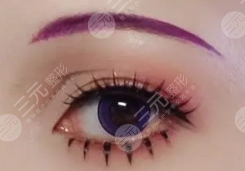 南京胡亮擅長做雙眼皮嗎