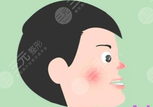 正頜手術(shù)風(fēng)險(xiǎn)大嗎