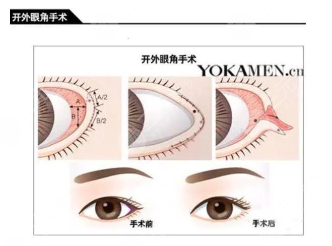 北京魏志香收費(fèi)高嗎