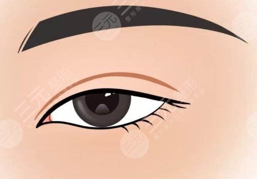 鄭州天后做單側(cè)雙眼皮提肌需要多少錢