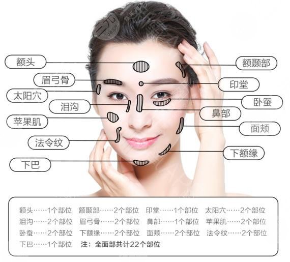 王紹國(guó)醫(yī)生做填充嗎