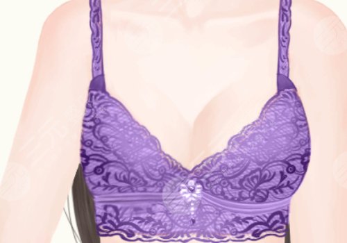 做假體豐胸有什么危害和后遺癥嗎