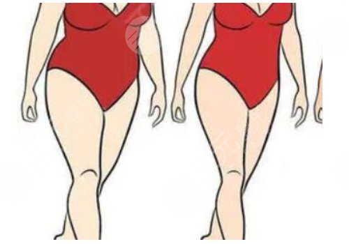 水動力吸脂多少錢一部位