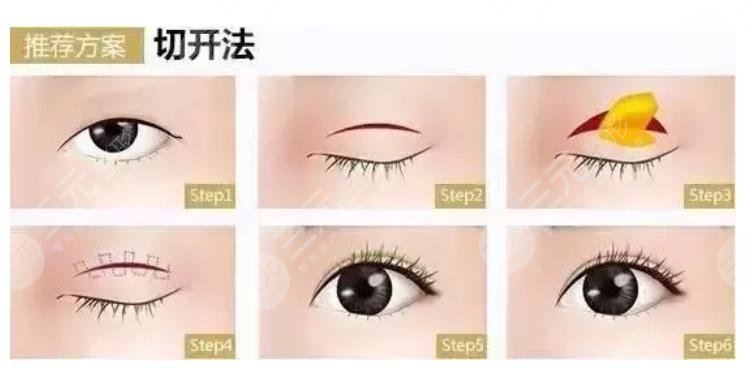 蚌埠醫(yī)學(xué)院第一附屬醫(yī)院整形外科特色項(xiàng)目