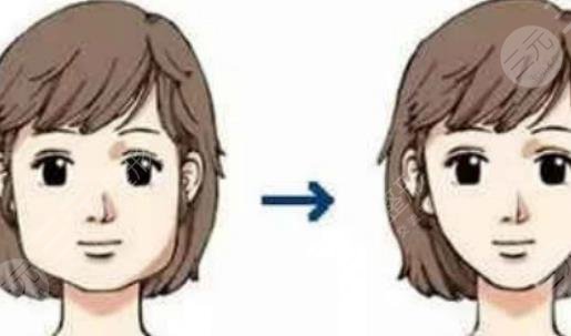 上海東方醫(yī)院整形外科特色項(xiàng)目