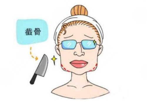 下頜骨整容整形的方法