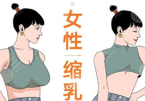 縮胸手術真實案例前后對比圖案例分享