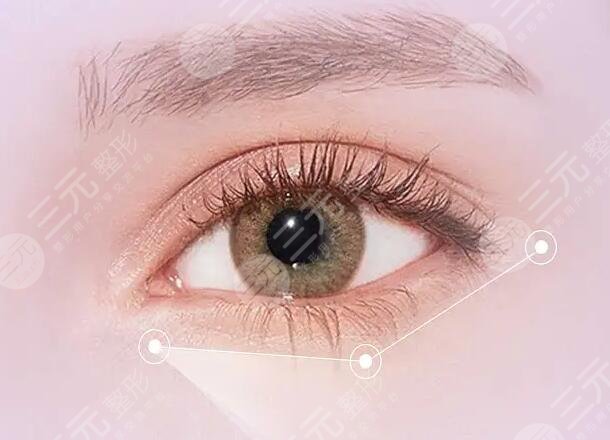 長春趙自然做修復雙眼皮怎么樣？手術(shù)要排多久？資料、實力、案例簡介