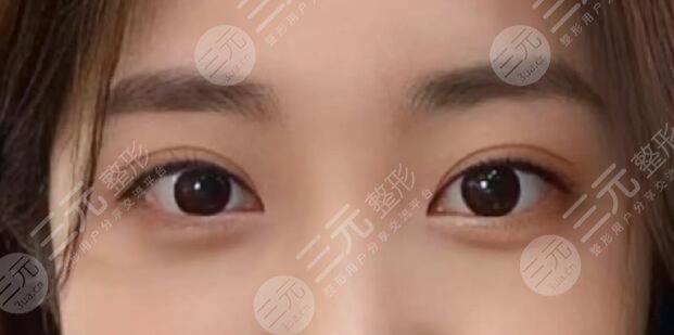 肖貴喜醫(yī)生做雙眼皮怎么樣啊？醫(yī)生個(gè)人實(shí)力測(cè)評(píng)，就職醫(yī)院是哪家？