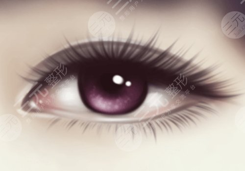 敖健飛做雙眼皮自然嗎