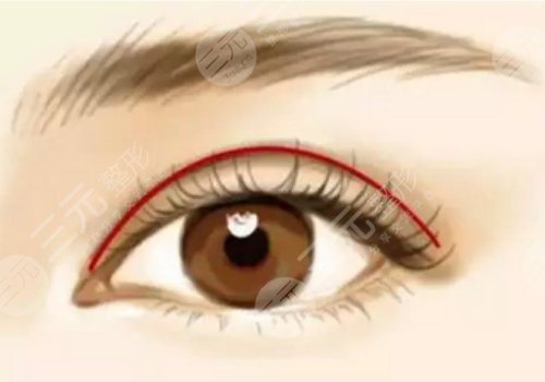 新鄉(xiāng)市中心醫(yī)院雙眼皮手術(shù)價格