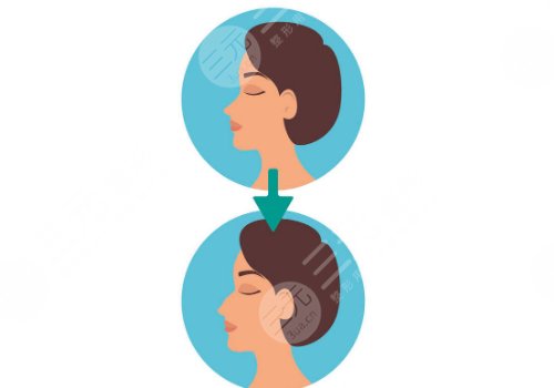 輪廓固定怎么做