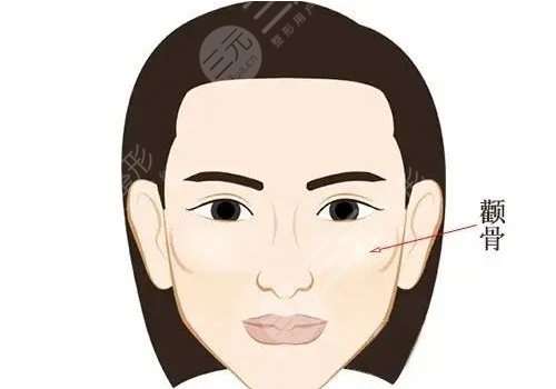 顴骨內(nèi)推多少錢(qián)