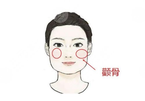 顴骨內(nèi)推多少錢(qián)