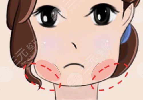 上海伊萊美削骨怎么樣