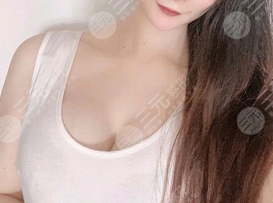 水滴型假體隆胸前后對(duì)比效果圖片和手術(shù)過(guò)程分享，小白隆胸避坑！