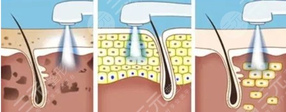 安徽醫(yī)科大學(xué)第一附屬醫(yī)院整形美容中心特色項(xiàng)目