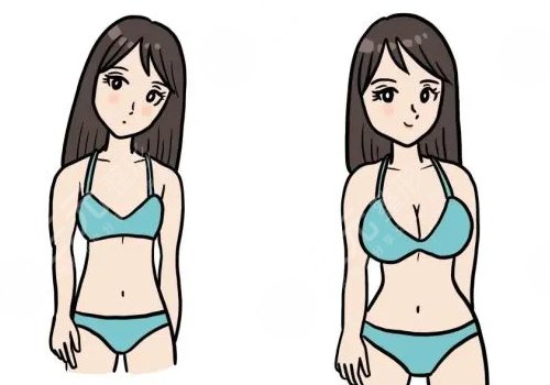 假體隆胸的牌子