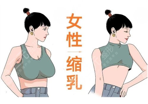 做縮胸手術(shù)需要多少錢(qián)