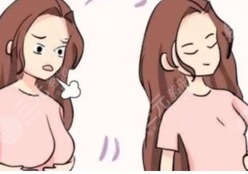 做縮胸手術(shù)需要多少錢(qián)