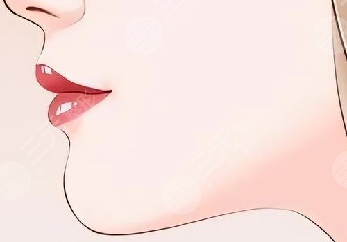 整容下巴需要花費多少錢呢