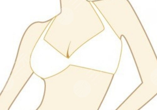 八大處辛敏強乳房下垂手術(shù)