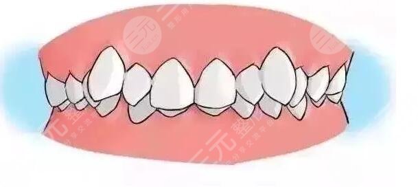 牙齒矯正