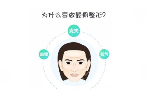 上海九院顴骨內(nèi)推醫(yī)生 