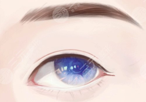 覃方燕雙眼皮多少錢