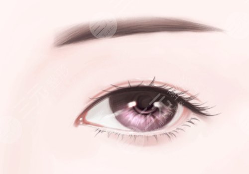 覃方燕雙眼皮多少錢