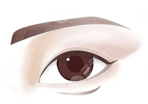 武漢曾佳雙眼皮