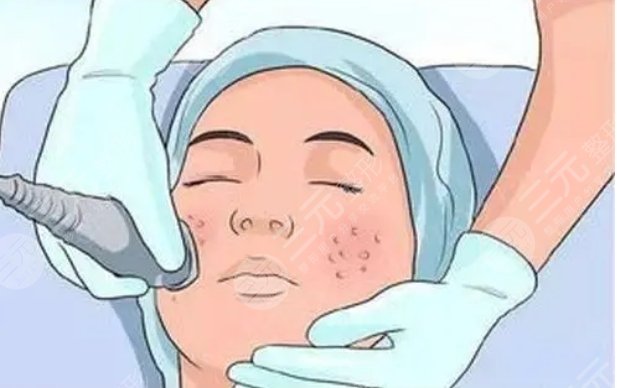 武漢同濟醫(yī)院激光祛斑案例