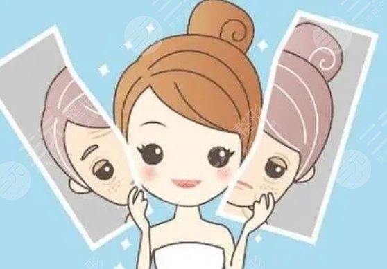 新星靚耿立碩醫(yī)生激光去皺案例