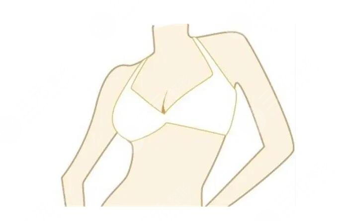 內(nèi)窺鏡隆胸和普通隆胸有什么區(qū)別