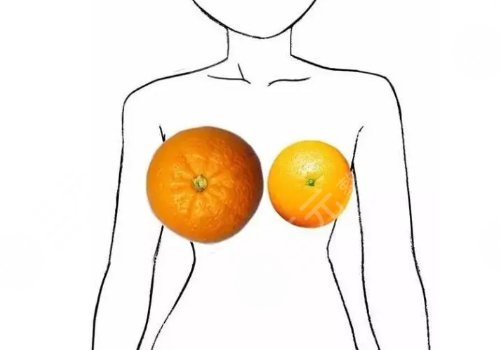 蘇州市立醫(yī)院縮胸手術(shù)費(fèi)用