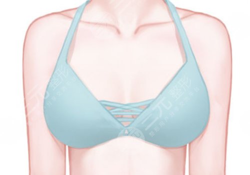 淄博中心醫(yī)院縮胸多少錢